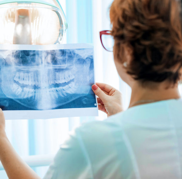 Back view female dentist looks at orthopantomogram in her hands